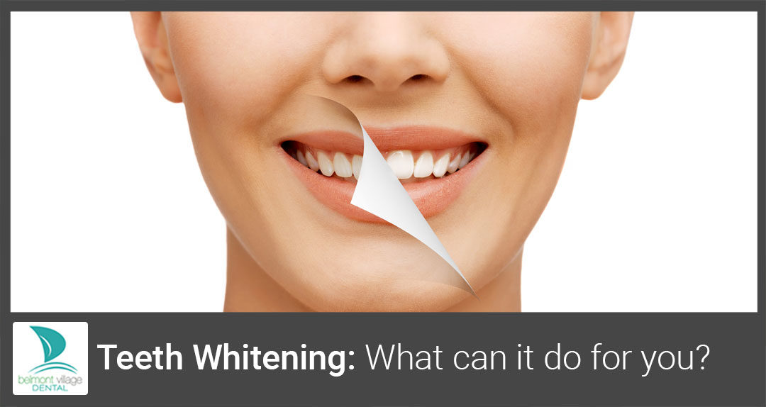What Can Teeth Whitening Do For Me?